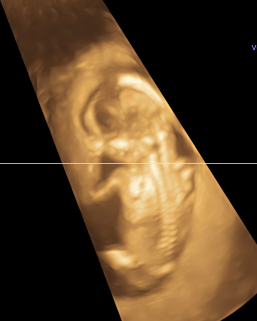 DR IMAGEM - FEED - 04